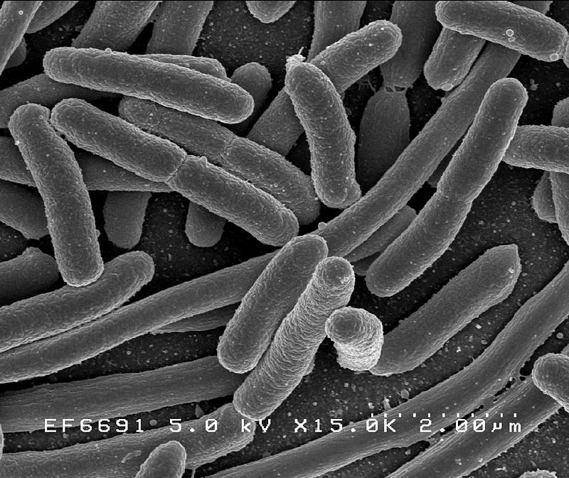 https://species.wikimedia.org/wiki/Escherichia_coli#/media/File:EscherichiaColi_NIAID.jpg)